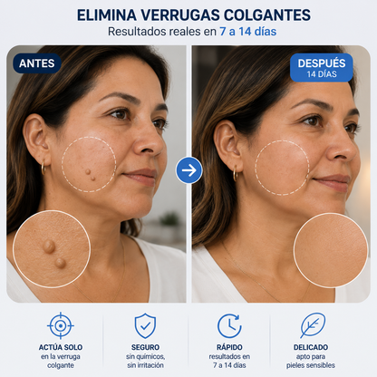 DEMPURE - Kit Eliminador de Verrugas Colgantes
