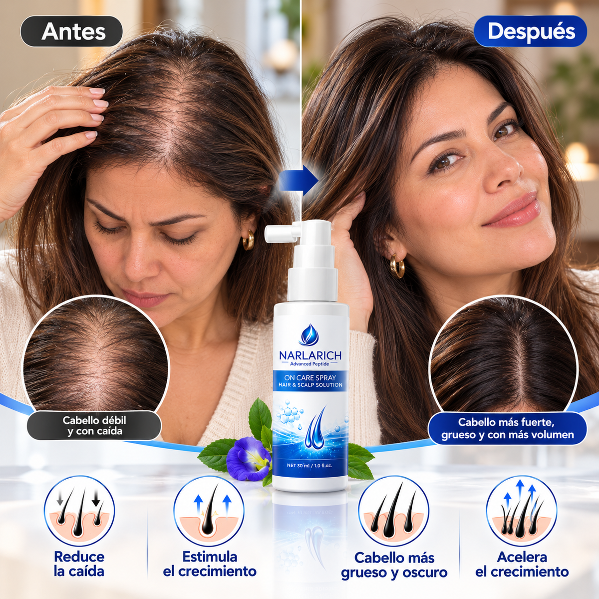 Narlarch - Spray Tónico para el Crecimiento Capilar (TIKTOK)