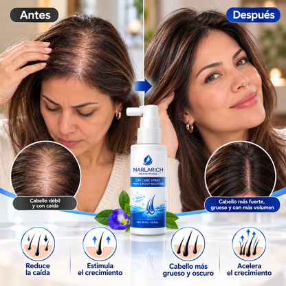 Narlarch - Spray Tónico para el Crecimiento Capilar (TIKTOK)
